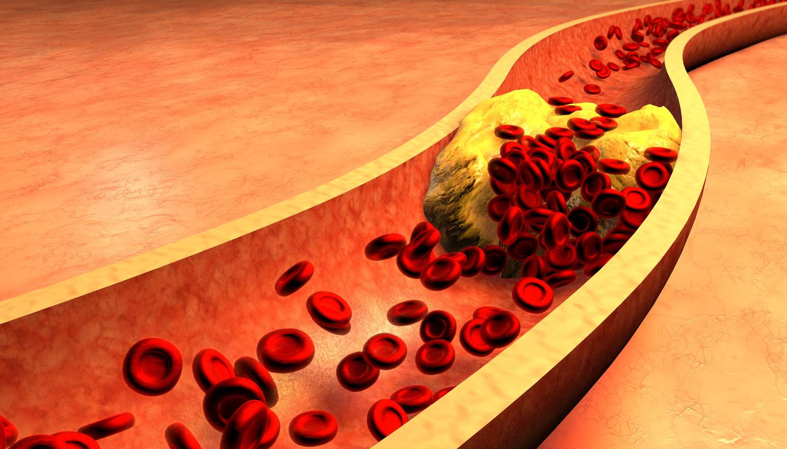 cholesterol-2026-08-01-2-PORTAL